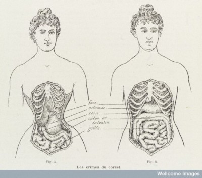 L0038404 Illustrations to denounce the crimes of the corset Credit: Wellcome Library, London. Wellcome Images images@wellcome.ac.uk https://wellcomeimages.org 2 Illustrations to denounce the crimes of the corset and how it cripples and restricts the bodily organs in women. Engraving 1908 Published:  -  Printed: 10th October 1908 Copyrighted work available under Creative Commons by-nc 2.0 UK, see https://wellcomeimages.org/indexplus/page/Prices.html